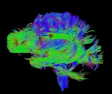 BrightMatter Plan Image of Brain